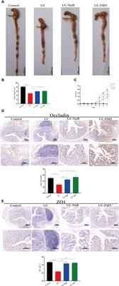 Sodium butyrate treatment and fecal microbiota transplantation provide relief from ulcerative colitis-induced prostate enlargement